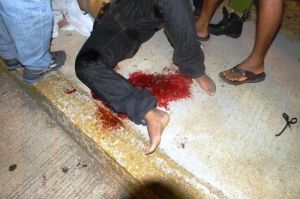 Tuvo una fuerte pérdida de sangre ante los balazos en la pierna.