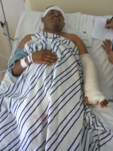 Olivio Castro Morales casi pierde el brazo luego de un machetazo por gente del pseudo-líder vende lotes, Juan Manuel Valdéz.