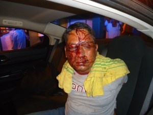 El delincuente fue sometido a golpes por los mismos pasajeros; se llama Ricardo Golpe Toga,-de 48 años de edad.