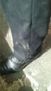 El pantalón manchado de verde es la evidencia del atropello de la patrulla de Tránsito del Estado hacia su persona. "Me echaron el carro encima", dijo el joven Galmiche.