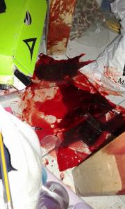 Escena del crimen, de los hechos sangrientos.