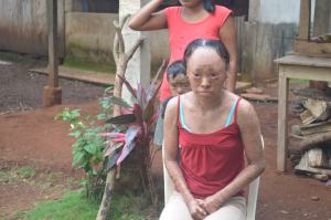 Necesitan apoyo en medicamentos, que son muy costosos y no son cubiertos por el sector salud.