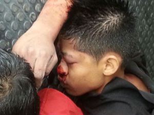 En su rostro, en la frente se ve el tiro de gracia.