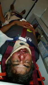 Le dieron tremenda golpiza que lo llevaron al Hospital.