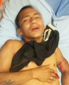 Uno de los jóvenes heridos de gravedad.