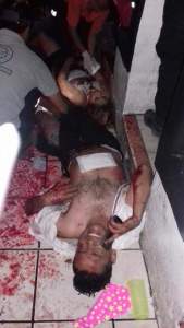 Hay por lo menos 12 heridos, algunos están de gravedad.