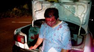 Le dieron salvaje golpiza.