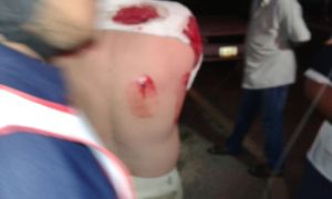 Le dieron un balazo por la espalda. Todavía vive.