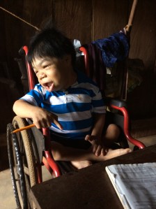 Gilberto Pascual Martínez tiene 28 años pero nunca creció, desde que era un bebé... se quedó como un bebé.